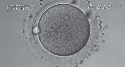 あなたの声を聞かせてください ヒト受精卵を研究に使ってもいいですか 科学コミュニケーターブログ