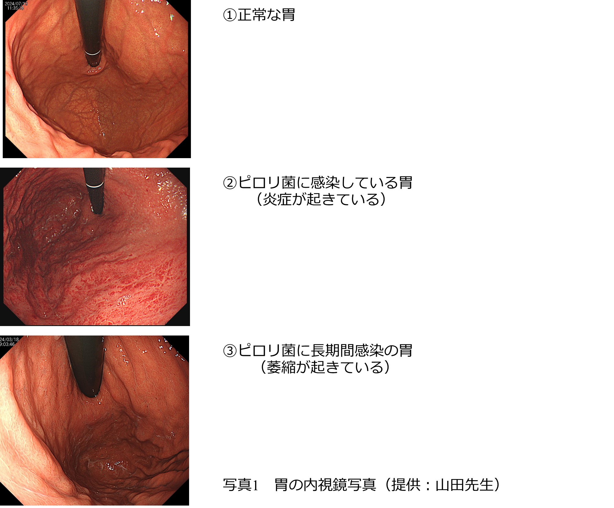 20250301_hiraoka_11.jpg